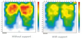 PolyAir cushions for very high risk pressure ulcers